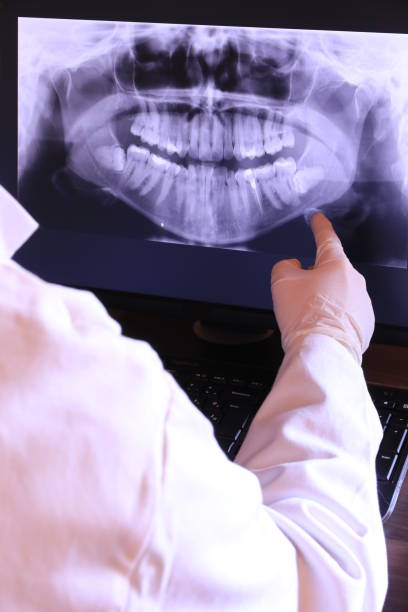 Best Broken or Cracked Tooth Emergency Dentist in Grandview, IL