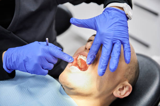 Best Emergency Dentist for Lost Fillings or Crowns in Grandview, IL